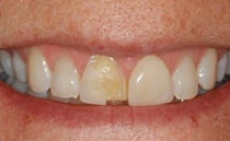 Featured Case before photo